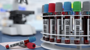 Od próbki po diagnozę – jak pracują laboratoria, nie tylko w czasie pandemii?