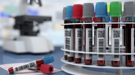 Od próbki po diagnozę – jak pracują laboratoria, nie tylko w czasie pandemii?